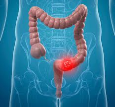 Colonic & Castor Oil Pack