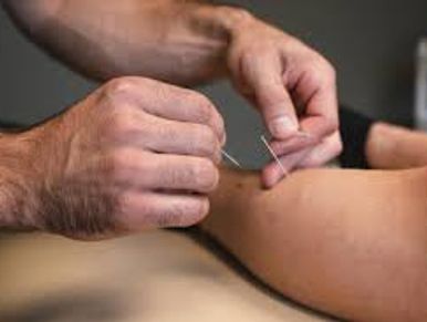 Close-up of acupuncture being performed on a person's leg.
