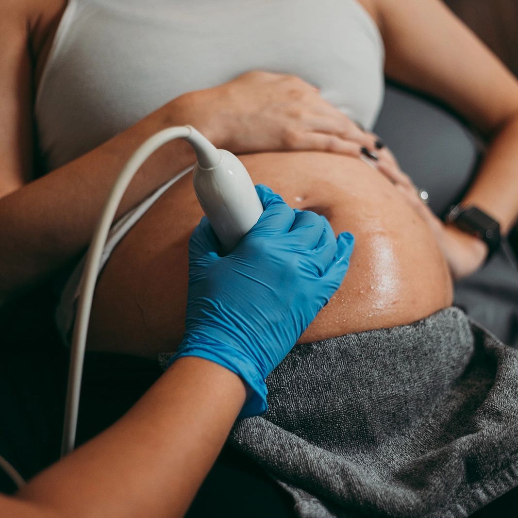 InFocus Ultrasound