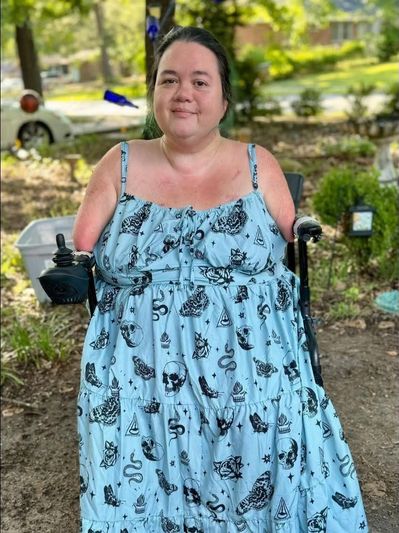 A woman with fair skin, dark brown & teal hair, 1/2 of both arms, in a wheelchair wearing a dress.