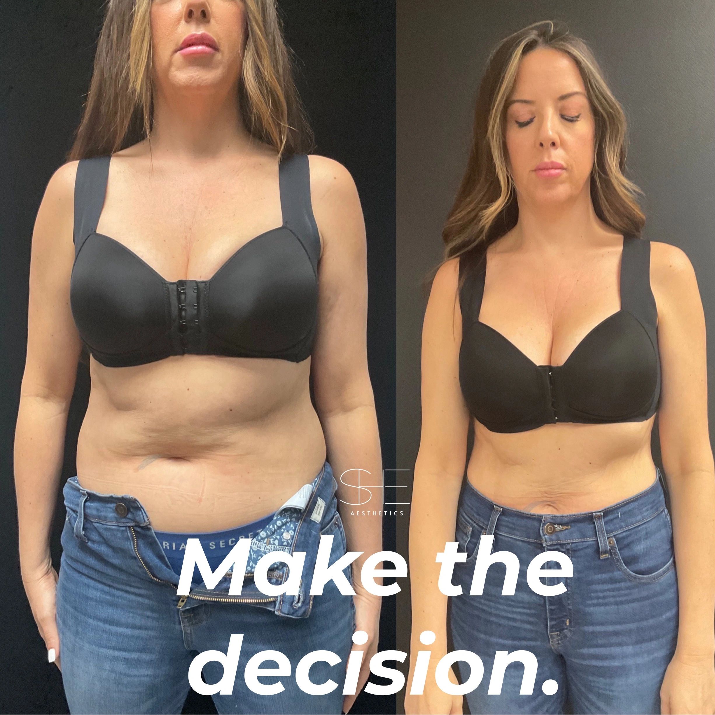 Semaglutide Weight-Loss Videos Are Flooding TikTok, Instagram