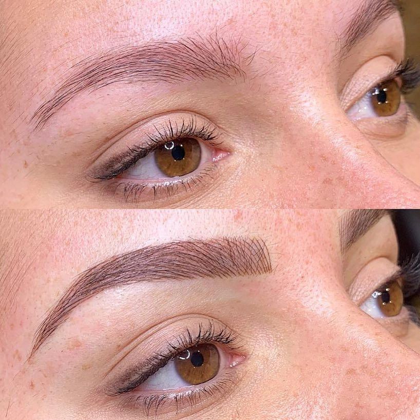 What Do I Need to Know About Scabbing?