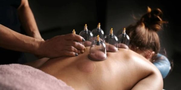 Person receiving a cupping therapy session on their back.