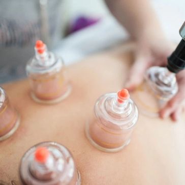 Dry cupping - Pain specialist in Gorakhpur - Hijama and cupping