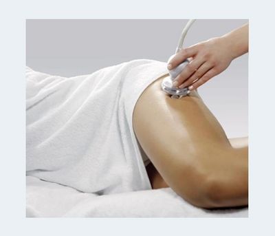 What Is Laser Lipo?