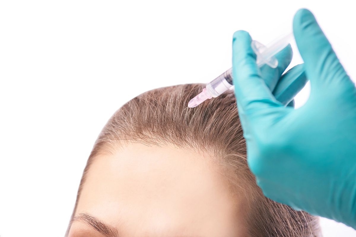 PRP Hair Injections