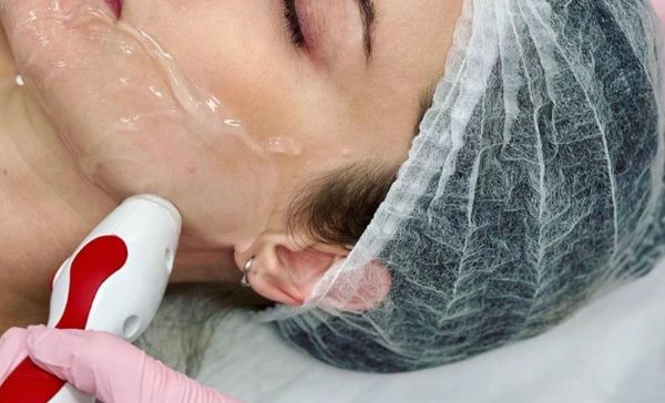 The Thuzzle Radio Frequency Skin Tightening Single Wave in use