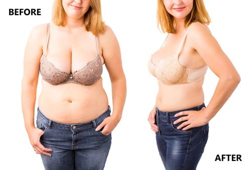 MEDICAL FITNESS -WEIGHT LOSS - WELLNESS
