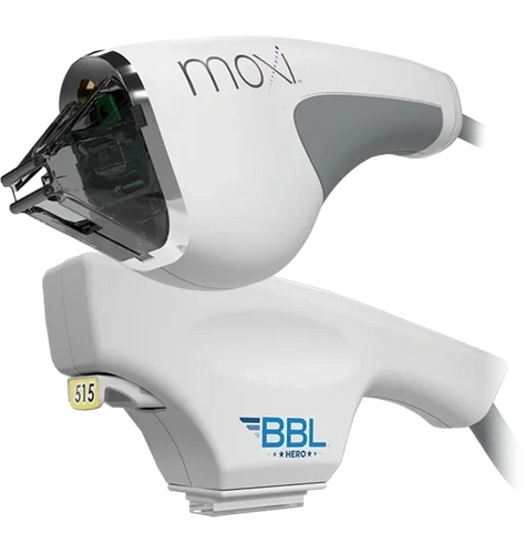 The powerful combination of MOXI® and BBL™