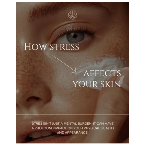 Close-up of a freckled face with text about stress affecting skin health.