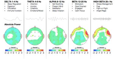 Out of balance qEEG ( quantitative EEG )brain scan. 