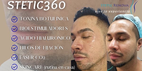 Protocolo de rejuvenecimiento facial con técnicas avanzadas.