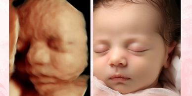 8k imaging ultrasound 
