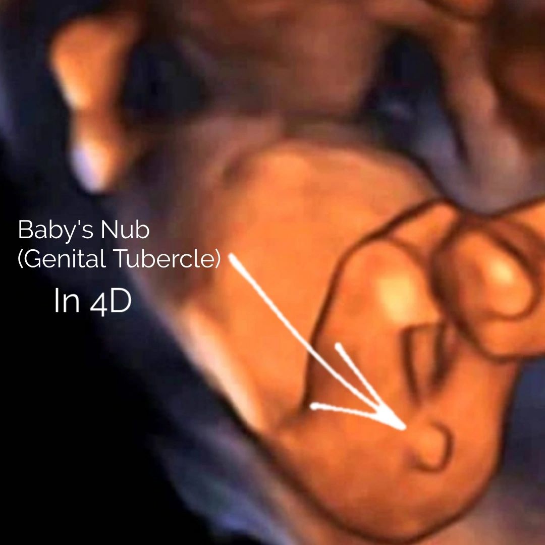 nub theory gender prediction nub genital tubercle