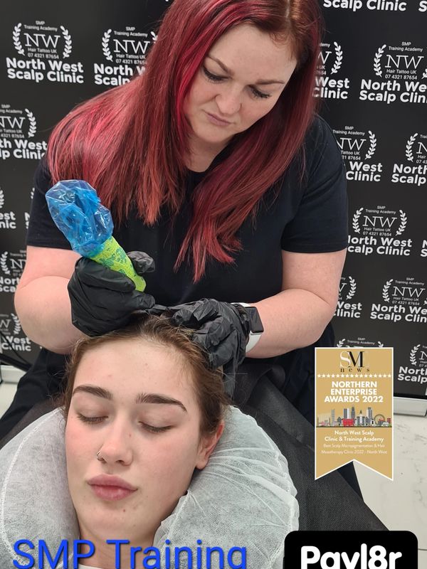 Scalp Micropigmentation Treatment & Training Scalp Micropigmentation Treatment & Training