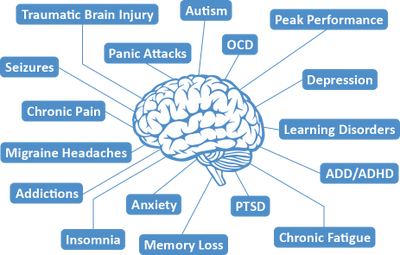 Brain dysfunctions 