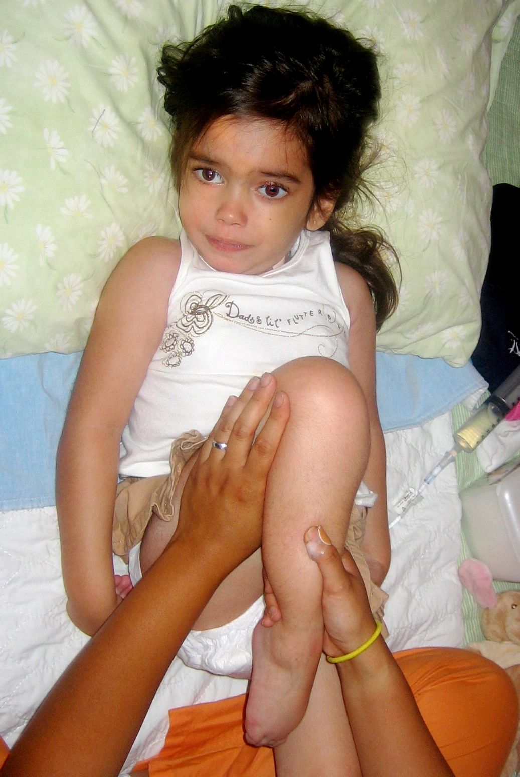 Rachaeli Fier, an 8-year-old with Tay-Sachs doing her exercises