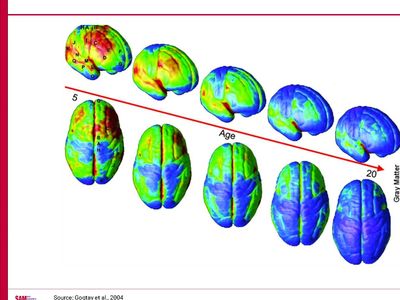 Brain Development from ages 5 - 25.
Blue = mature;  red = immature 