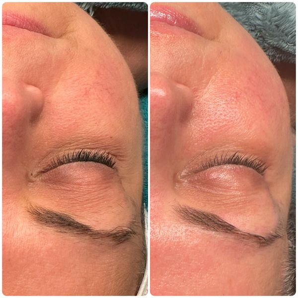 Ultimate Skin Renewal Facial, see description on Facial page. 