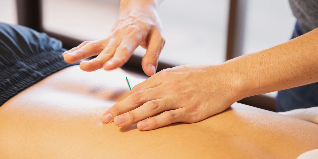 A man being treated with IMS or Intramuscular Stimulation. A service offered at KT Physiotherapy