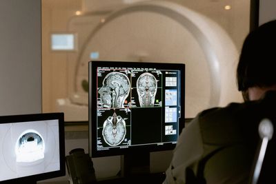 Reviewing an MRI scan