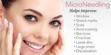 Womans face showing the benefits of MicroNeedling