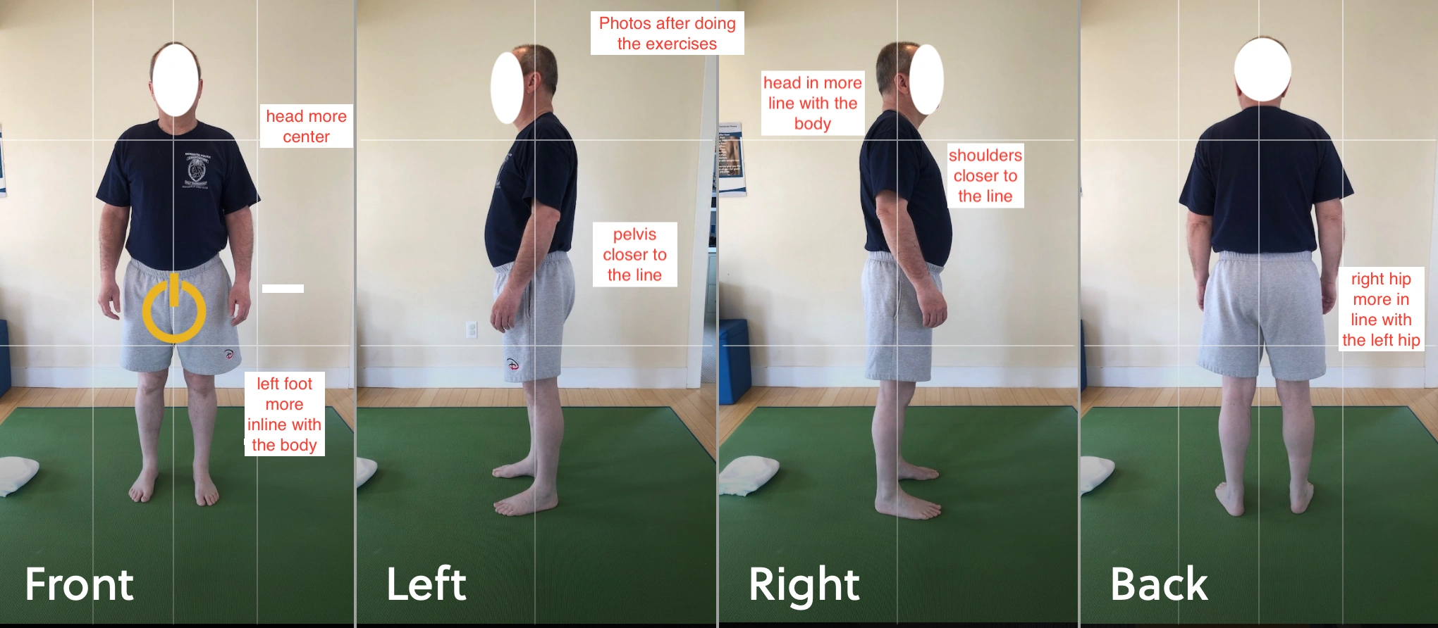 client02-before-and-after-02 - Upright Posture Fitness - Look