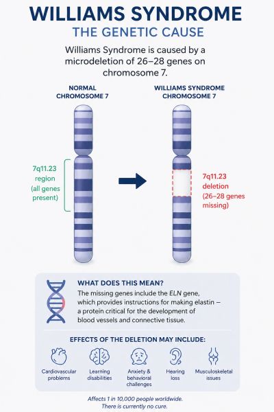 Diagram explaining genetic cause of Williams Syndrome.