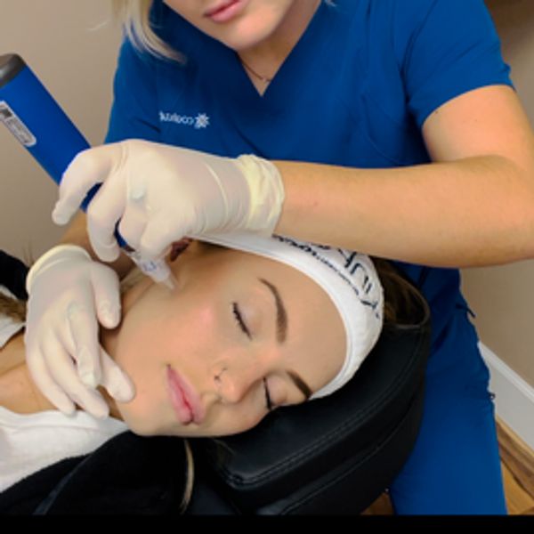 Micro-Needling