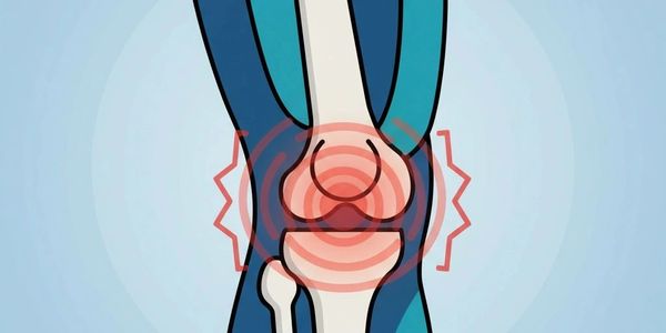 Illustration of knee pain with highlighted joint area.