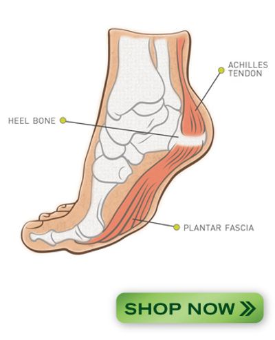 Diagram of foot anatomy showing Achilles tendon, heel bone, and plantar fascia.