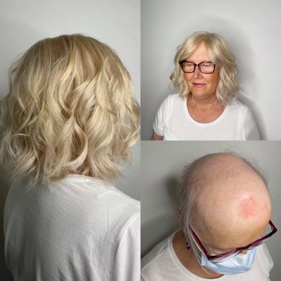 Transformation of a woman wearing a blonde wig over her bald head.