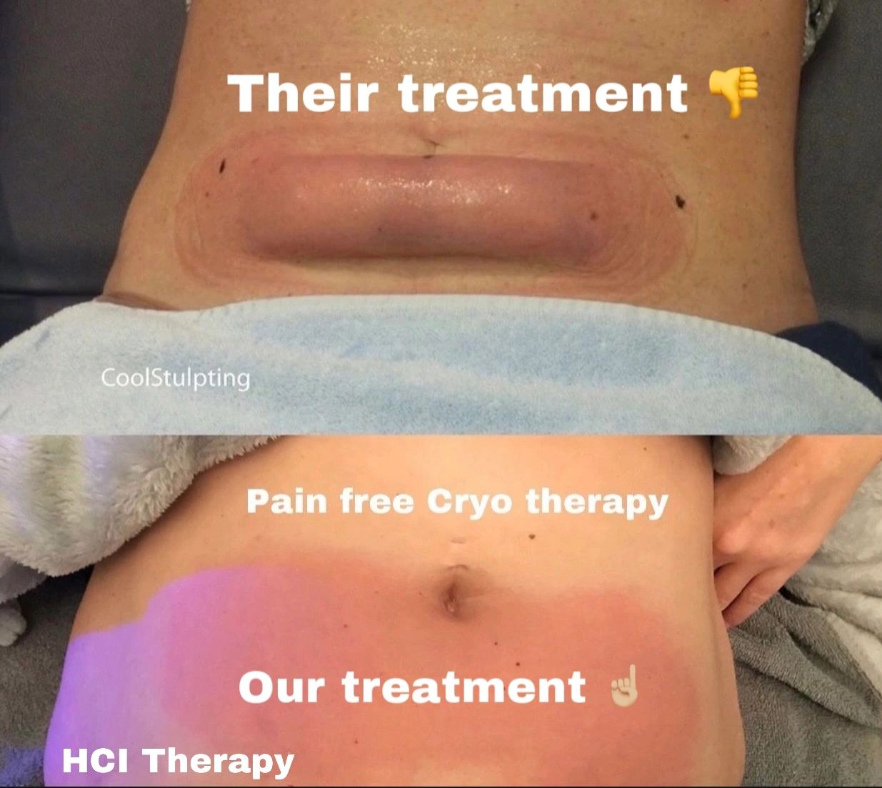 CryoSlimming, CryoToning, CryoFacial, CryoToning, Cryo Pain Relief