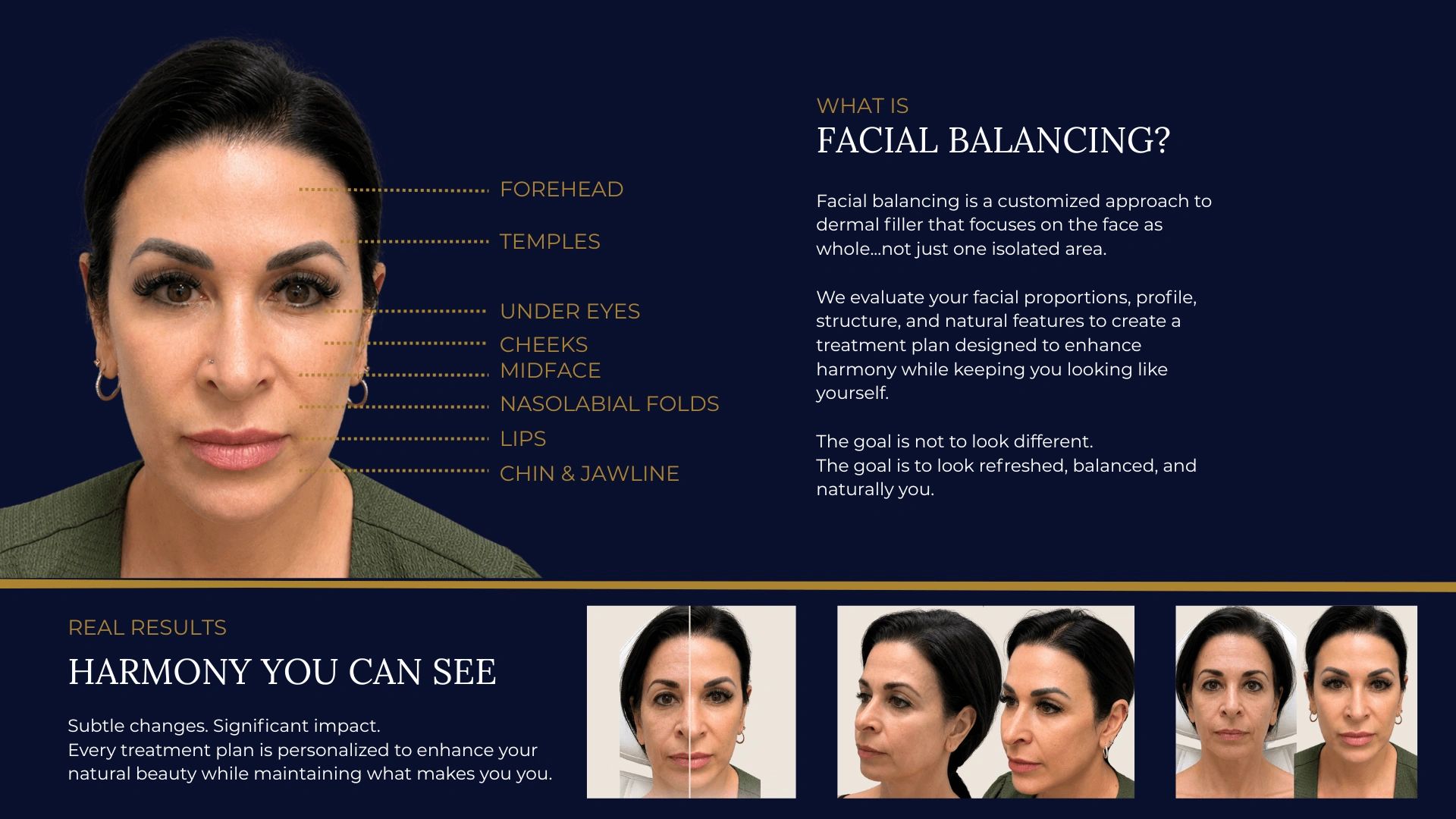 Facial balancing involves dermal fillers to enhance facial harmony and natural look.