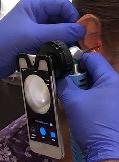 EAR MICROSUCTION