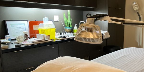 Experience the wonders and relaxation of acupuncture and how it can elevate your wellness In Canmorel