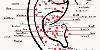 Auricular Acupuncture 