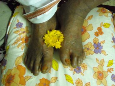 Worn feet resting on a floral cushion, adorned with a yellow flower.