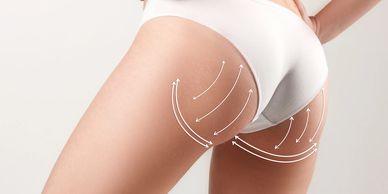 Close up image of a girl hip with some white arrows