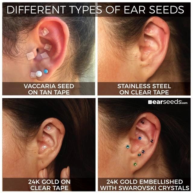 Ear Seeds