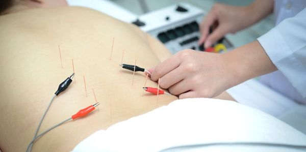 Electro-Acupuncture