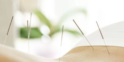 Acupuncture, Portland OR, Shiatsu Massage, Chinese Herbal Medicine, 