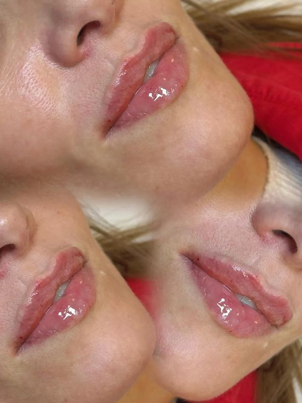 Close-up of glossy, plump lips in a multi-exposure style image.