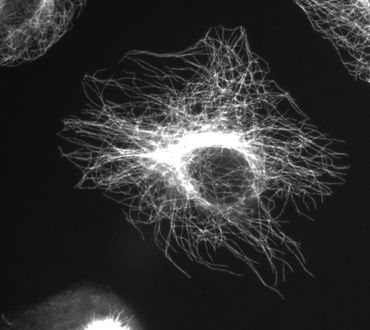 Stained Microtubules streaming out from cell nucleus 