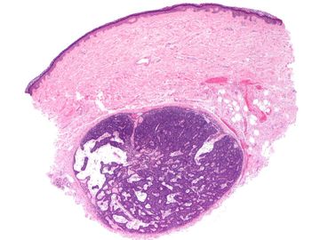 Biopsia