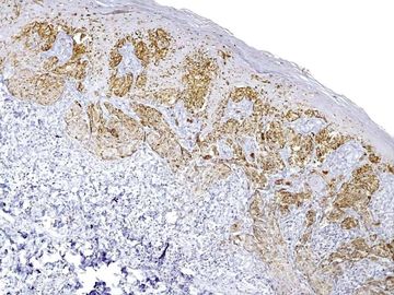 Inmunohistoquímica