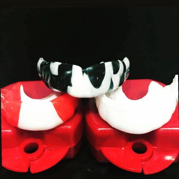 Custom Mouthguards