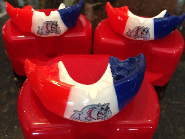Team Mouthguards 