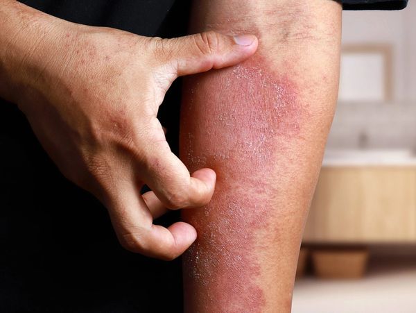 Mora Medtech UK Limited