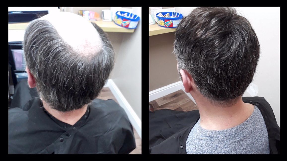 New U Hair Hair Replacement & Hair Extensions Durham Hair